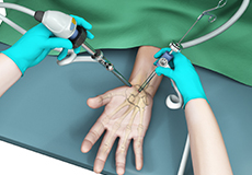 Wrist Arthroscopy